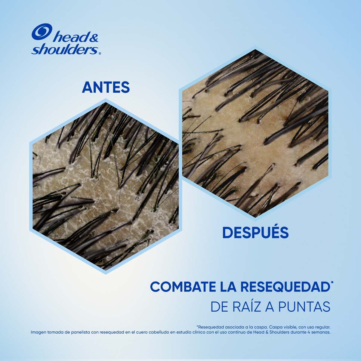 Head & Shoulders Shampoo S Anti-resequedad Nutrici&oacute;n Diaria, Miel Aceites Y Esenciales 375 Ml image number null