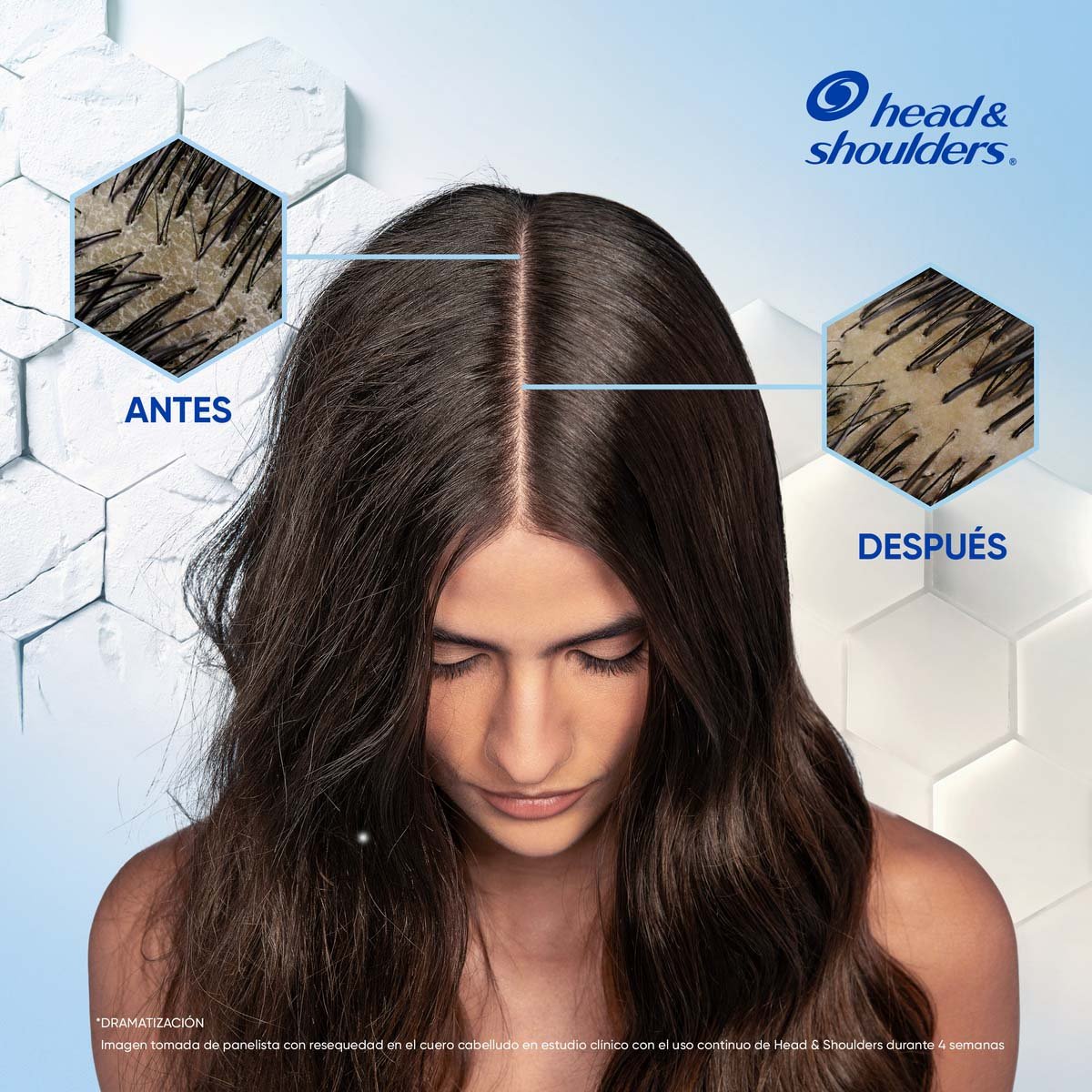 Head & Shoulders Shampoo S Anti-resequedad Nutrici&oacute;n Diaria, Miel Aceites Y Esenciales 375 Ml image number null
