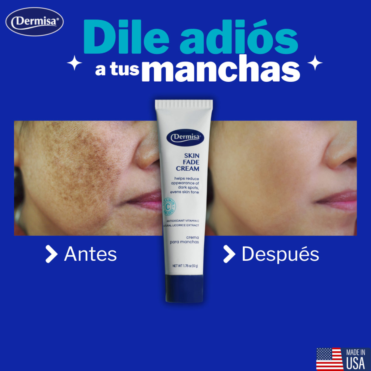 Dermisa Crema Para Manchas Con Vitamina C Y Extracto De Regaliz Natural 50 G image number null