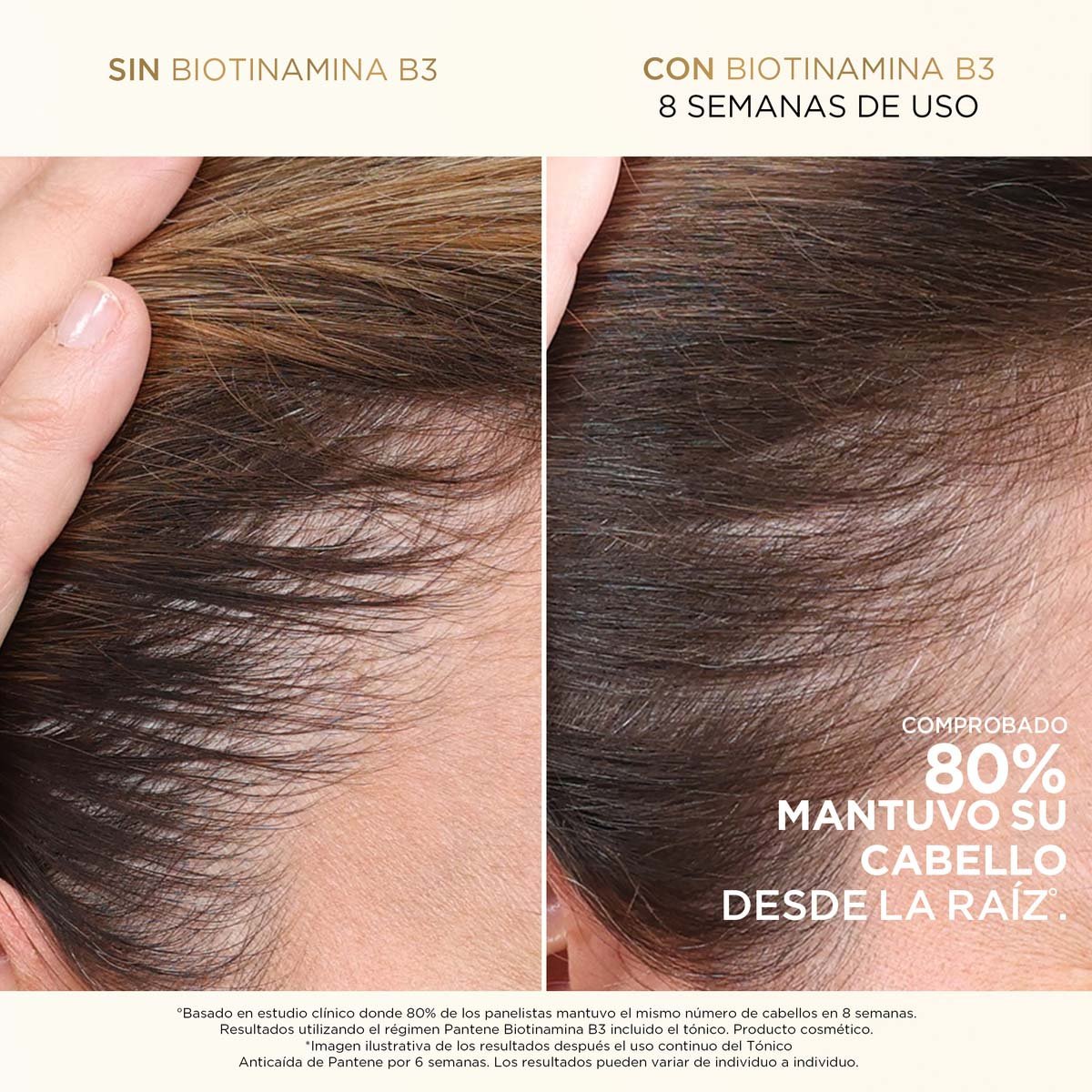 Pantene Acondicionador Antiquiebre Biotinamina B3 Para Cabello Fr&aacute;gil Y Quebradizo 250 Ml image number null