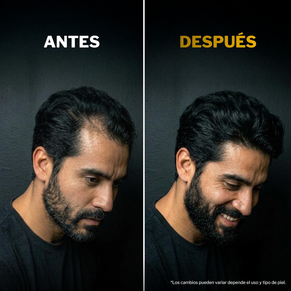 T&oacute;nico Capilar con Minoxidil Andros 120 ml image number null